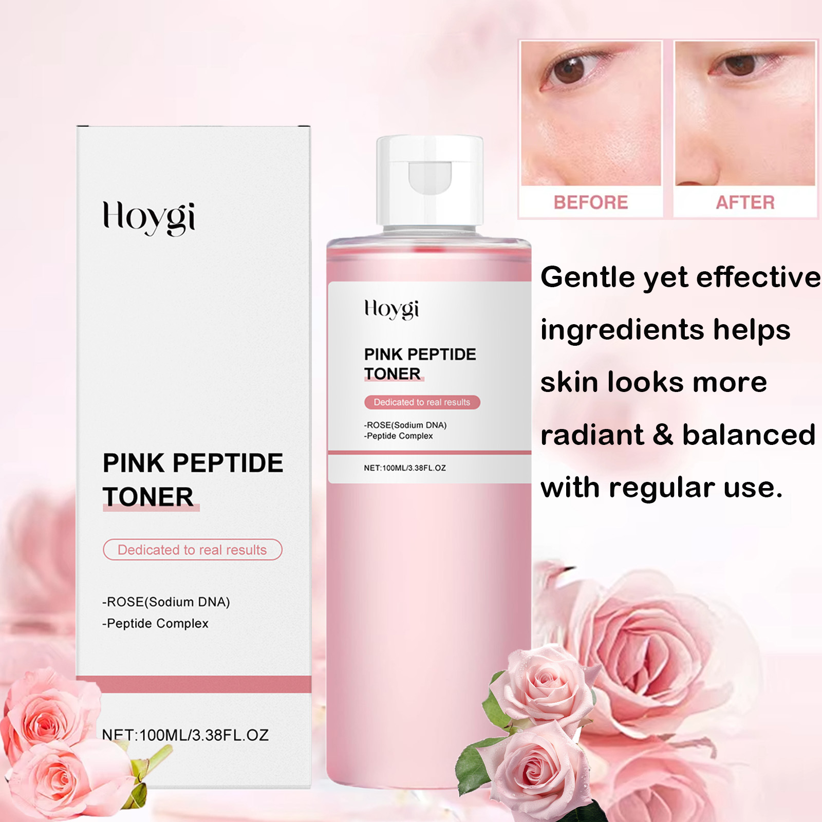 Rose Essence Toner Glowing Ski - Rose Water Spray review and price
